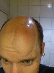 Biestikk